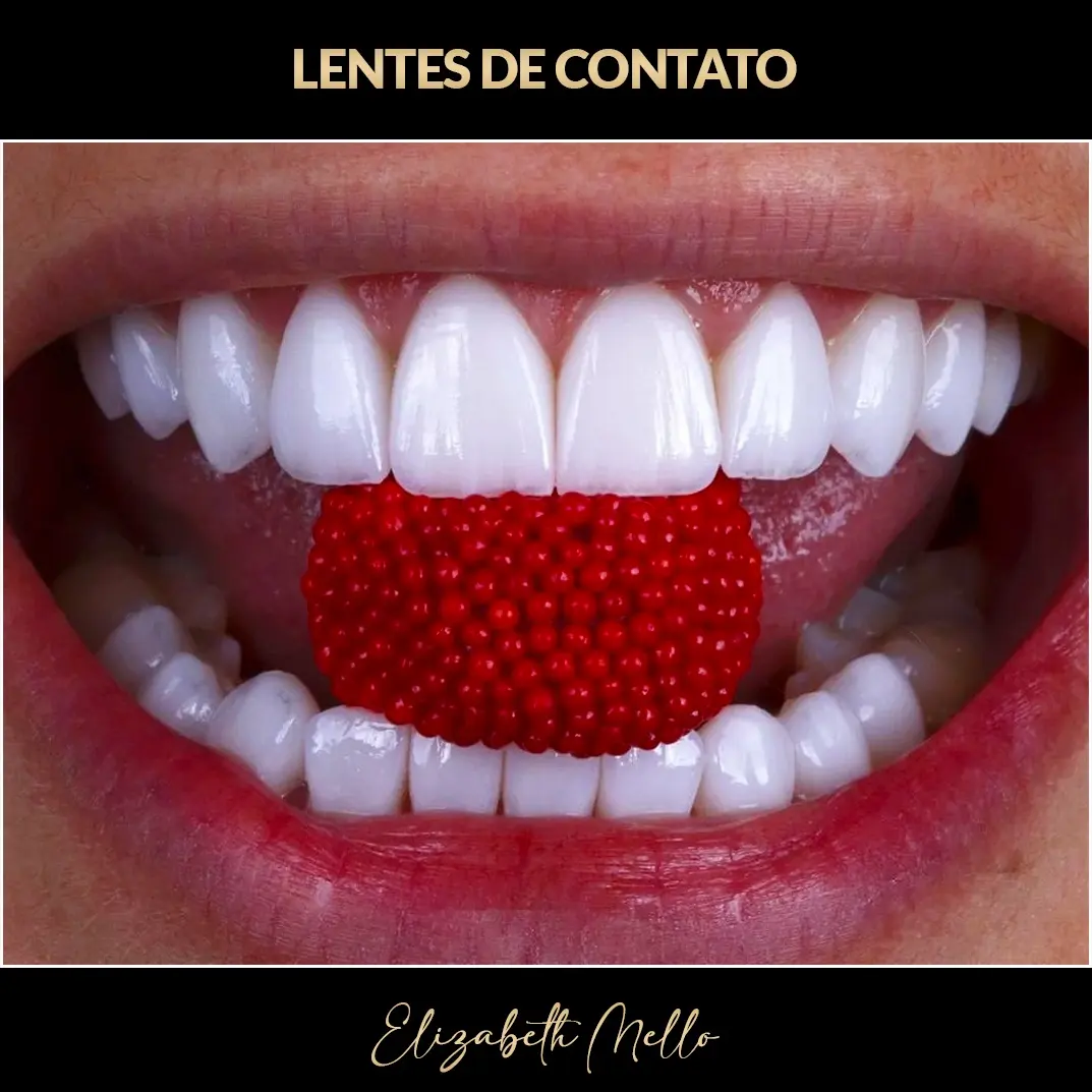 Resultado de lentes de contato dental em porcelana